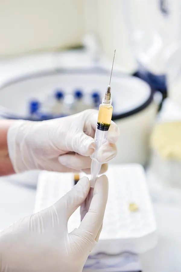 Frequently Asked Questions about PRP