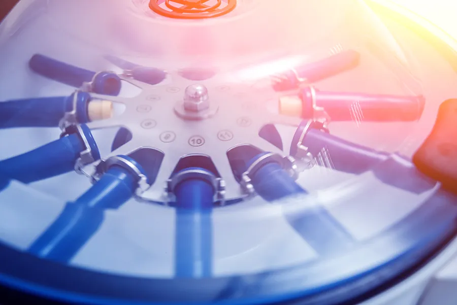 Platelet Rich Plasma Therapy