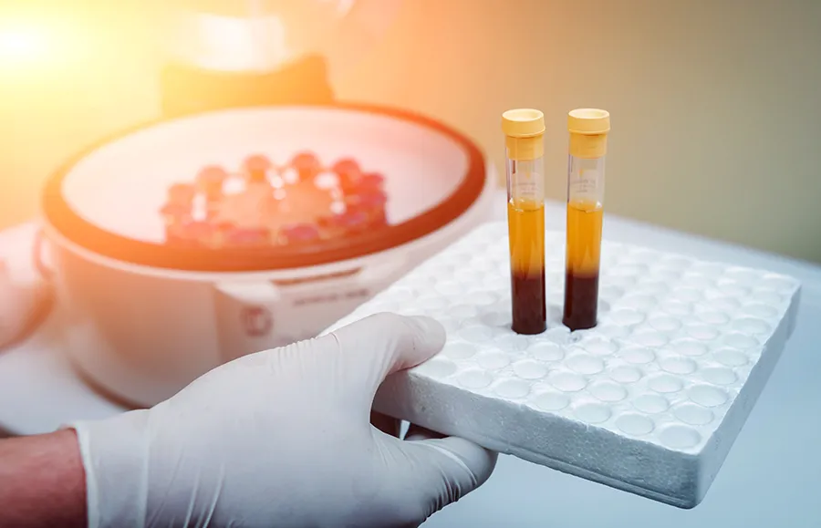 platelet-rich-plasma-treatments-find-doctors PRP Treatments - find doctors