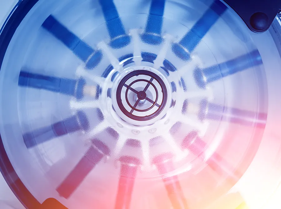 what-is-platelet-rich-plasma Platelet-Rich plasma preparation. Tube with blood in centrifuge.